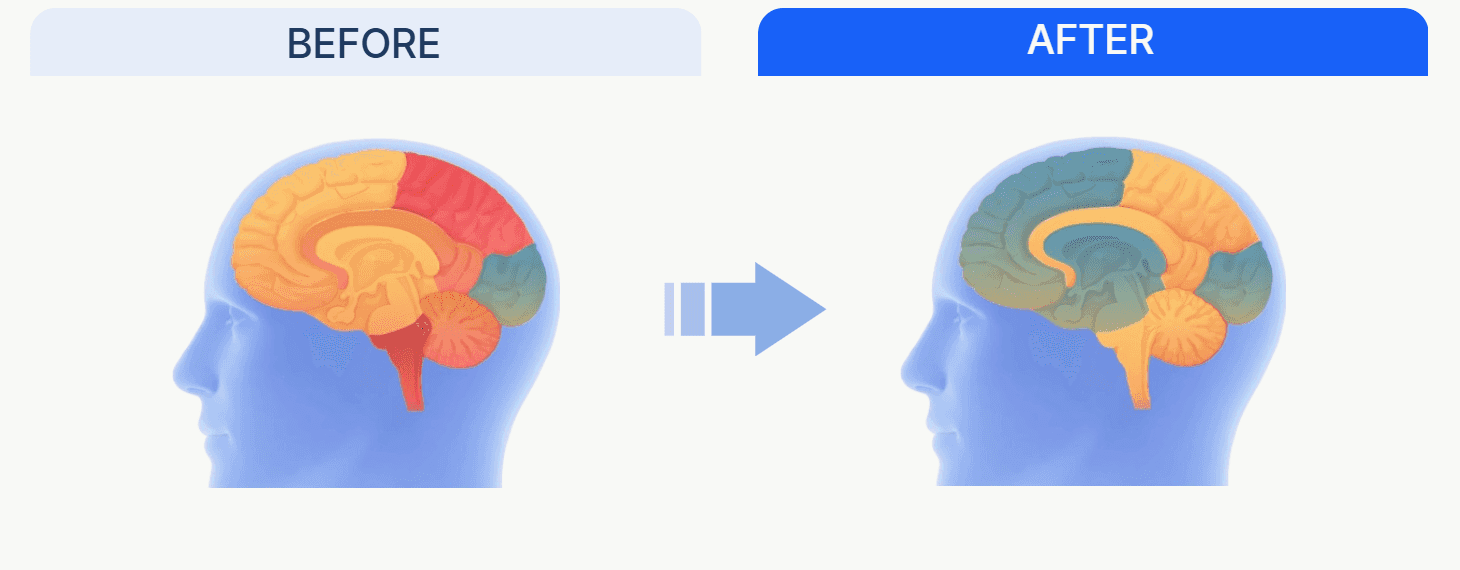 Whole-brain engagement BEFORE AFTER